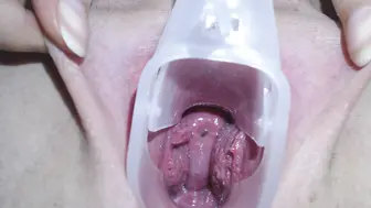 能清晰的看到子宫