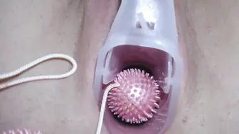 能清晰的看到子宫